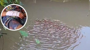 Bocah Diserang Ikan Gabus Raksasa, Tangannya Luka Parah